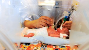 Rizikoví novorodenci. Ministerstvo chce zrušiť špecializovanú ambulanciu