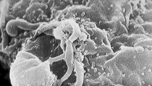 Len druhý človek na svete. Transplantácia kmeňových buniek zbavila muža vírusu HIV