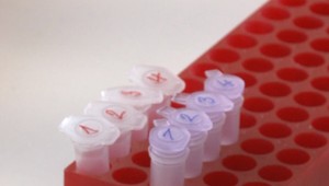 Česká lekárka vyvinula rýchlejšie testy na koronavírus. Na Slovensko už mieria tisíce objednávok