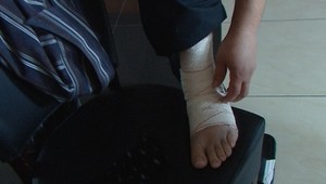 Vytkli ste si členok? Ak počujete tento zvuk, určite sa neliečte sami!