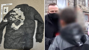 V prípade podpálenia 11-ročného chlapca vidí polícia úmysel. Obvinila jeho kamaráta