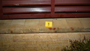 Pes napadol tri dievčatá priamo na chodníku. Najstaršia skončila s vážnymi zraneniami nôh