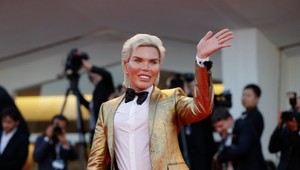 Živý Ken si na Vianoce doprial ďalší bolestivý zákrok, chce byť spevákom