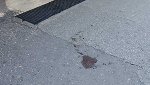 Petra pobodal útočník v centre Bratislavy. Dotackal sa pred známy bar, pomohli mu ochrankári