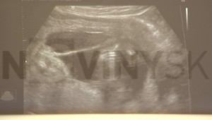 Richard Müller (50) bude po tretí raz otcom