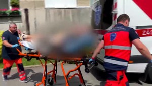 Brutálny útok rotvajlerov, muža hrýzli takmer do bezvedomia