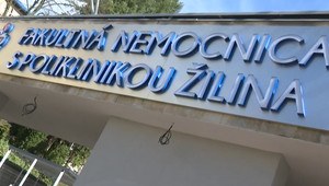 Ide o prístup alebo len o výplaty? Žilinskú rádiológiu opúšťa 16 technikov