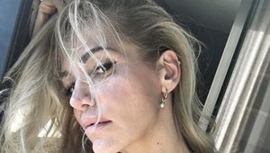 Dara obeťou domáceho násilia! Chce o tom hovoriť nahlas