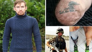 Fanúšik LFC prišiel o nohu, zostalo mu: You'll never walk