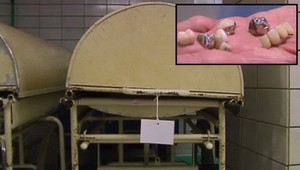 Hyenizmus! Mŕtvej starenke z úst vytrhli zlaté zuby