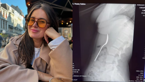 Pozor, na obyčajnú činnosť. Žena pri nej prehltla celú lyžicu