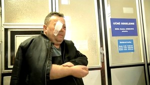 Po zákroku policajtov prišiel o oko. Navyše hrozí Stanislavovi trestné stíhanie