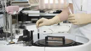 Testovanie na zvieratách je kruté, pripomína Svetový deň laboratórnych zvierat