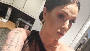 Na vysnívanú plastiku pŕs cestovala do Turecka: Svoje rozhodnutie ľutuje, TAKTO dopadla