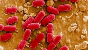 Baktéria na šaláte zabila 5 ľudí, ďalších takmer 200 skončilo v nemocnici