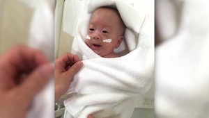 Najmenšie bábätko na svete: Po narodení vážilo len 268 gramov