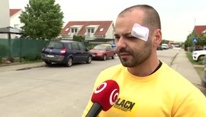 Po výbuchu bytovky prišla Lukášova rodina o strechu nad hlavou. Explózia ho zranila