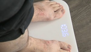 Slovensko patrí v Európe medzi krajiny s najvyššou mierou obezity. Odborníci upriamujú pozornosť na prevenciu a multidisciplinárny prístup