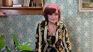 Česká hviezda si pre túžbu po mladosti nechala zničiť tvár, speváčku zrádzajú aj hlasivky!