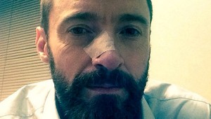 Hughovi Jackmanovi sa vrátila rakovina!