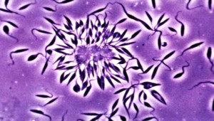 Na svete je nový vírus. Ľudí likviduje pomaly, ale isto...