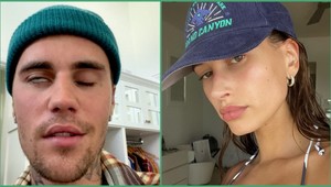 Bieber priznal ochrnutie polovice tváre, potom prišla reakcia jeho manželky Hailey!