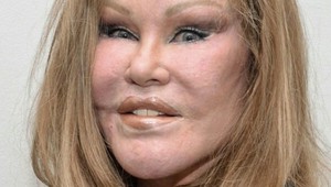 Plastikami znetvorená mačacia žena sa bude vydávať