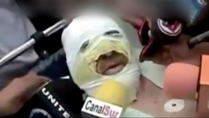 Pomsta novinárovi. Podpálili ho priamo počas rozhovoru