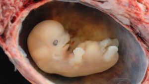 Bábätko sa narodilo rodičom 4 roky po ich smrti. Vybojovali si ho starí rodičia