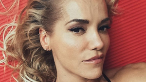 Dara a botoxové pery! TENTO muž ju odmietol po zákroku pobozkať!