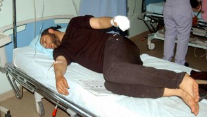 Záchvat zúrivosti pacienta si odskákal iný. Požiar ho vážne zranil