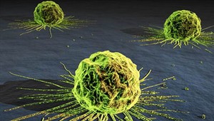 OTÁZKY A ODPOVEDE. Rakovina hrubého čreva, tichý zabijak