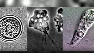 Chlapec (11) bojuje o život v nemocnici. Potvrdili, akým druhom parazita sa nakazil