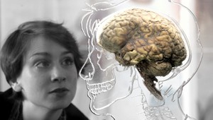 Vedci tvrdia, že mozgové bunky sa naozaj obnovujú. Vyvinú liek na Alzheimerovu chorobu?