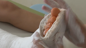 Deti opäť vytiahli bicykle či kolobežky. Počet úrazov na urgente stúpa