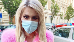 Český plastikový Honza plní svetové magazíny! TAKÉTO extrémne pery nemá nikto!