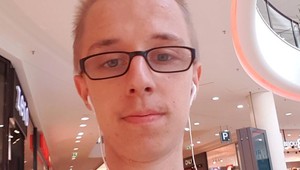 Z obyčajného chalana závislák na úpravách: Jeho vzhľad naháňa strach!