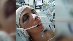 Chcel brániť ženu, skončil v kóme. Útočník hodil muža na betón