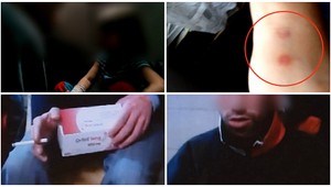 Otec, čo týral Jarku (7) pálením cigariet, sa priotrávil