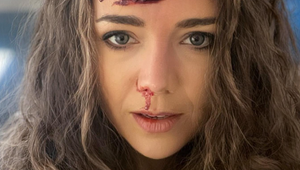 Rozchod s krvavým vyvrcholením?! Vondráčková šokovala dobitou tvárou!