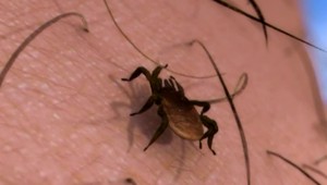 5 otázok a odpovedí o lymskej borelióze:  Aj keď sa nakazíte, ochorieť nemusíte