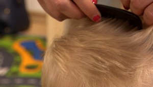 Na vši platí hygiena. Ak sa u dieťaťa vyskytne, nesmie ísť do školy, tvrdí Úrad verejného zdravotníctva