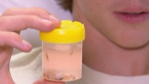 Napadli ho morské vši. Lekári boli šokovaní