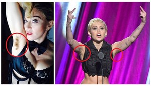 Toto nie! Celebrity odštartovali nový módny trend, neholia si podpazušie!