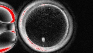 Prelom vo výskume neplodnosti: Vedci vytvorili rané ľudské embryá z kožných buniek