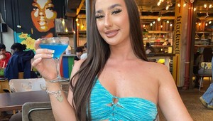 Kedysi ich zakrývala a hanbila sa za ne: Žena dnes hrdo ukazuje svoje telo