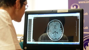 Budeme platiť za návštevu lekára? K téme sa vyjadrili aj víťazi volieb