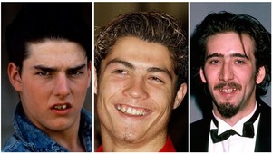 Fuj, toto mali v ústach! Celebrity pred úpravou chrupu