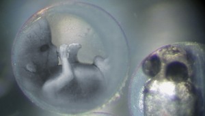 Vedci v USA prvýkrát opravili chybný gén ľudského embrya