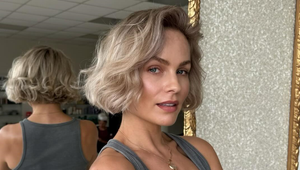 Ivana Gábríková ukázala tvár posiatu akné: Priznala, čo jej pomohlo!